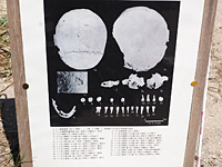 お墓1の頭蓋骨写真
